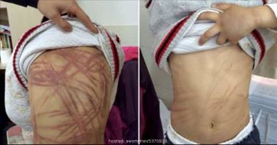 Boy Beaten Brutally By His Mom For A Very Simple Reason, Extremely Cruel!
