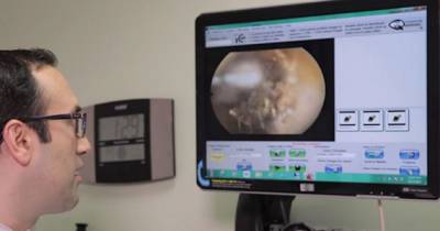 Disgusting! People Getting Earwax Removed For The First Time