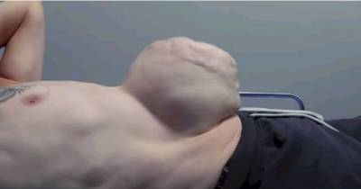 After Ignoring The Doctor&rsquo;s Advice For Years, This Guy Is Lucky To Be Alive