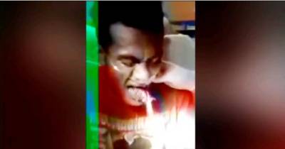 Excruciating Moment Doctor Struggles To Pull LIVE FISH Out Of Man's Throat