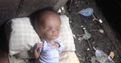 Abandoned, Sickly Baby Gets Adopted By A Real Hero