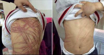 Boy Beaten Brutally By His Mom For A Very Simple Reason, Extremely Cruel!