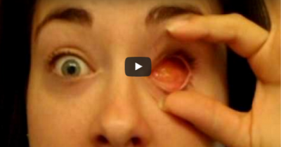 This Woman Removing Her Prosthetic Eye Is Creepy As Hell