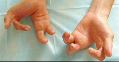 Uncommon Birth Defects Every Parent Needs To Be Aware Of