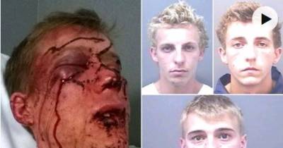 Dad Left 'Looking Like The Devil' After Savage Baseball Bat Attack Shares Pictures Of His Shocking Injuries