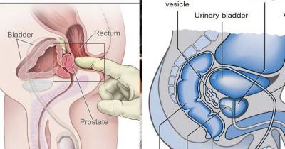 Deadly Symptoms Of Prostate Cancer That Must Not Be Neglected
