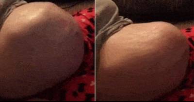 Dad Videos Their Unborn Baby Moving In The Womb. What Happens At 00:29 Will Freak You Out!