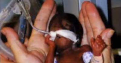 No Doctor Would Have Brought This Baby Into The World If Her Mother Hadn&rsquo;t Lied