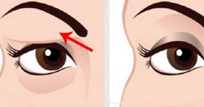 The Most Effective And Natural Remedy For Sagging Eyelids &ndash; The Results Are Instant!
