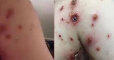 Her Son Cries With A High Fever. Then The Mom Realizes That Doctors Made This Terrible Mistake.