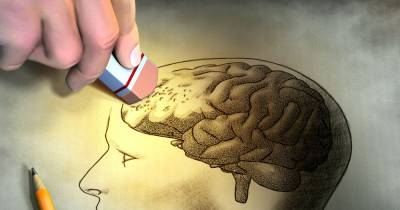 5 Hidden Causes Of Alzheimer's Most People Don't Know!