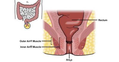 Early Symptoms Of Rectal Cancer You Must Be Aware Of