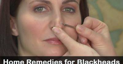 Remove Blackheads Naturally Without Pain