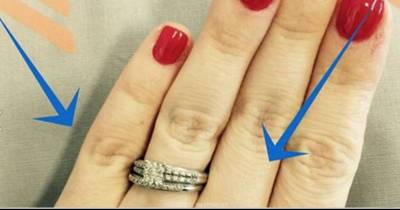People Noticed Something &lsquo;Off&rsquo; In Pic Of Woman&rsquo;s Wedding Ring. Now It&rsquo;s Going VIRAL