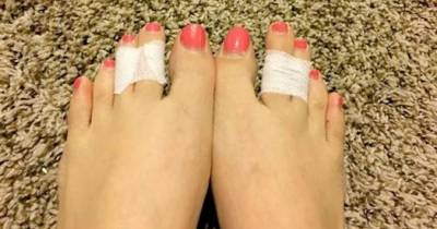 Women Are Taping Their Middle Toes Together,Here's Why!