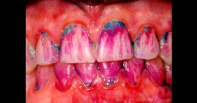Don't Brush After Wine, Snack on Cheese, and Other Dentist Secrets Revealed
