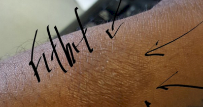 A Fitbit May Help You Lose Weight, But It Could Also Do THIS