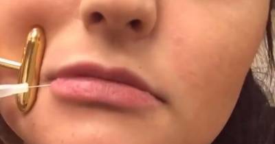 Is This How She Got That Pout? Kylie Jenner's Plastic Surgeon Posts Video Of Himself Giving Lip Injections
