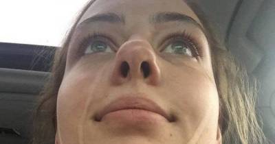 17 Year Old Learned The Hard Way Not To Cry After Getting A Spray Tan