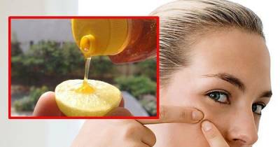 Tips To Get Rid Of Blackheads In No Time