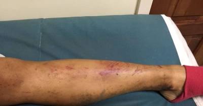 A Couple Was Enjoying Their Vacation Until Something Horrible Happened