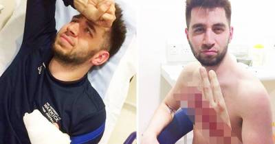 Man Left With Permanent &ldquo;Shocker&rdquo; After Ring Rips Finger Off (Gruesome)