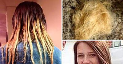 Girl's Hair 'BURNT OFF' When She Used A Home Dye Kit