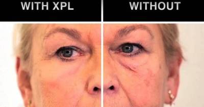 Scientists At MIT Just Invented A Cream That Makes Wrinkles Disappear!