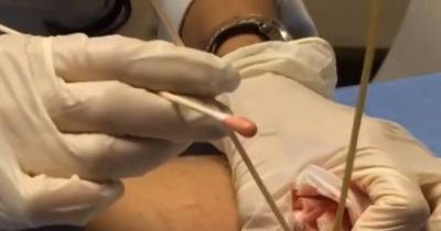 Huge Infected Cyst Explodes Like a Geyser