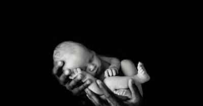 This Is What A Baby Who Was Born With 31 Fingers And Toes Looks Like