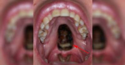 This Shocking Picture Demonstrates How Drugs May Be Gradually Consuming You From Inside.