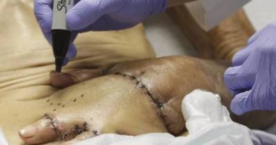 They Sew An 87-Year-Old&rsquo;s Hand Into His Stomach! But The Reason Why Still Astonishes Me.