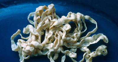 6-Meter-Long Worm Removed From A Man Who Eats Raw Beef