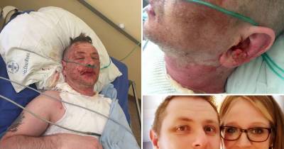 Omg!!This Man Is Scarred For Life After Having 'Acid' Thrown In His Face By Woman In A Bar