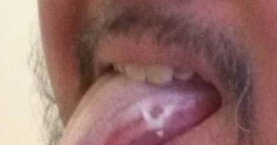 When His Friend Stuck Out His Tongue, He Called An Ambulance. This Test Can Save Your Life!
