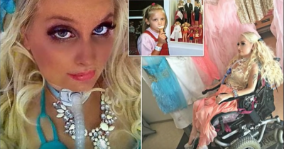 When She Was 9, She Was In A Horrible Accident. Her Parents Barely Recognize Her 17 Years Later.