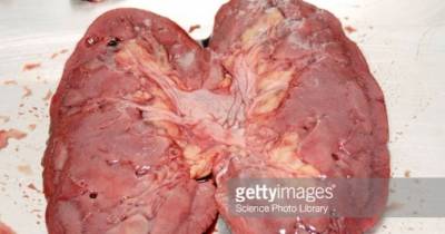 Pictures Of Human Organs Cut In Half.