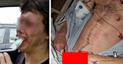 When He Left The Hospital, He Was Missing A Testicle, And No One Knew Why...Except The Surgeon