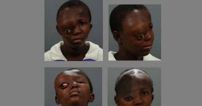 People Ran Away When They Saw Her On The Streets, But Now? Unbelievable!