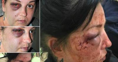 Woman Suffers Horror Injuries After Being Brutally Attacked In Flat 'By Man'