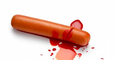 What&rsquo;s It Like When Your Manhood Snaps In Half? This Guy Knows