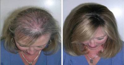 I Thought Castor Oil Was Only Used As A Laxative. I Never Expected This Would Happen If You Put It On Your Eyebrows.
