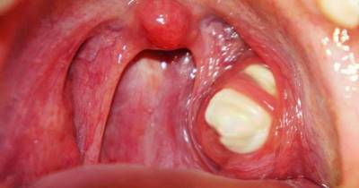 WTF: This Will Make You Never Want To Visit The Dentist AGAIN!