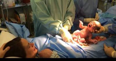 Baby 'Delivers Himself' In Amazing Video That Shows The Beauty Of Cesarean Births