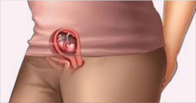 Early Pregnancy Symptoms &ndash; The Top Signs Before You Miss A Period