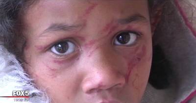 Fifth Grader Brutally Attacks First Grader In School Bathroom And Leaves Her Bloodied On The Floor