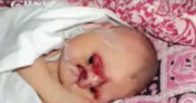 Mom Sees Baby's Face And Refuses To Keep Him, Then The Nurse Did The Unthinkable
