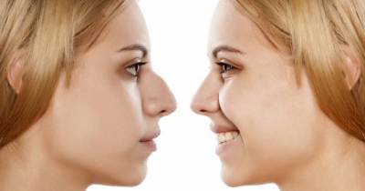 Why Your Nose Looks The Way It Does