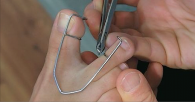 This Group Asks People To Check Between Their Toes. The Reason Is Very Important.