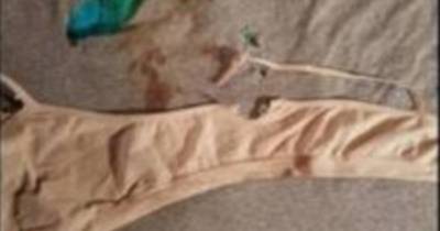 Shark Attacks In Florida Leave Girl, 11, And Woman, 57, Hospitalized Following Two Separate Incidents Along The East Coast